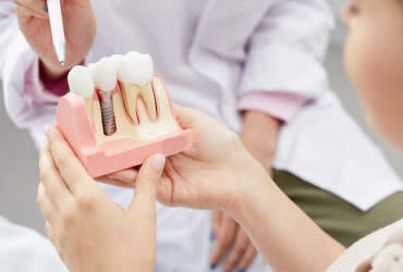 Replacing a Tooth with a Dental Implant