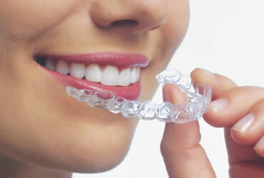 Invisalign and Children – A Good Fit?